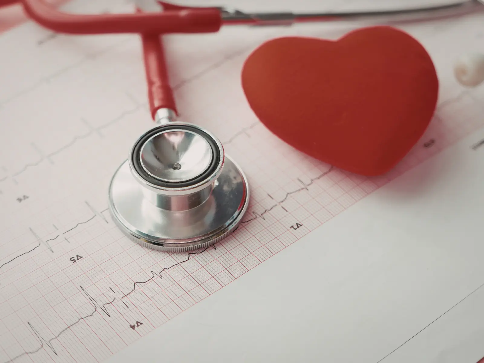 Electrocardiograma para estudio del ritmo cardíaco en Clínica La Pradera, Pérez Zeledón